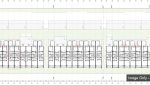 Page_4-_133_Anderson_Drive_Tarro-1200x466